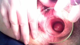 HappyMichelle Cervix Speculum Open Pussy